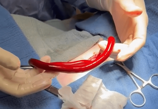giant red kidney worm